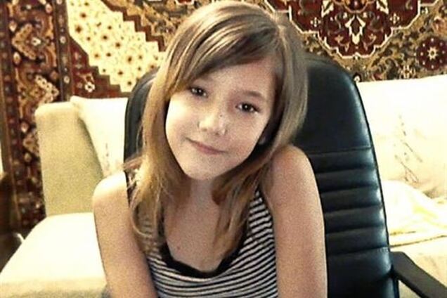 Спалена матір'ю 10-річна одеситка йде на поправку