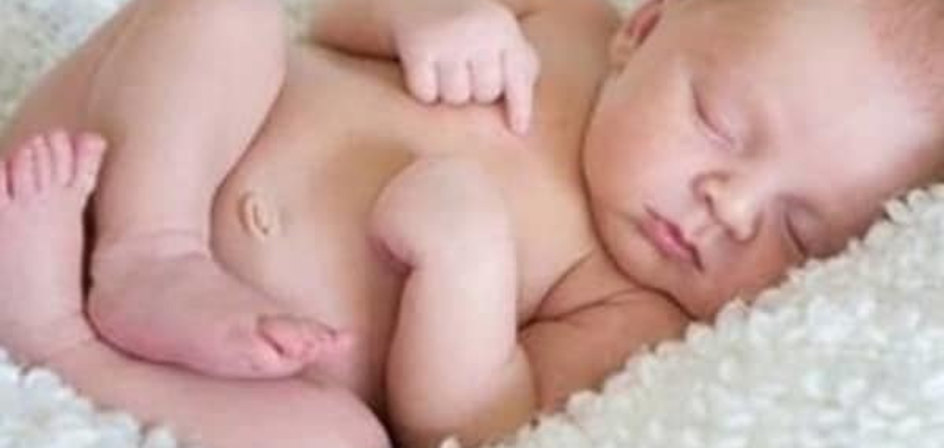 У новорожденного малыша на коже мягкий пушок? 