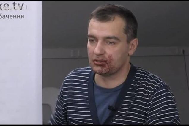 Милиционеров, попытавшихся помочь избитым журналистам, угрожают уволить