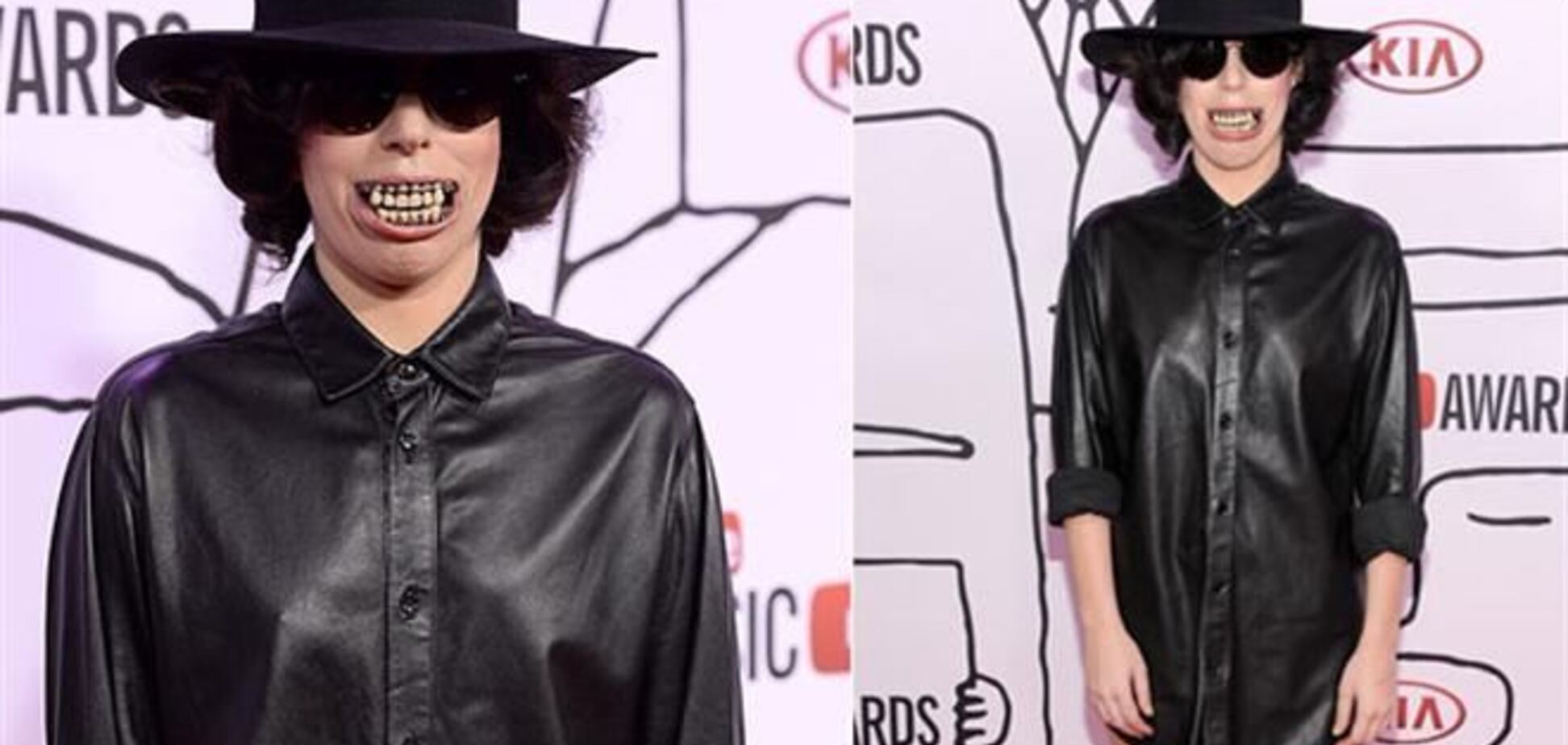 Леди Гага показала поклонникам свою вставную челюсть