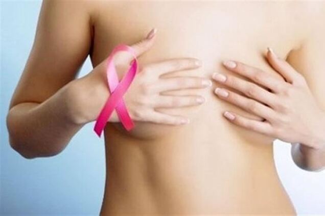 В мире становится все больше больных раком женщин