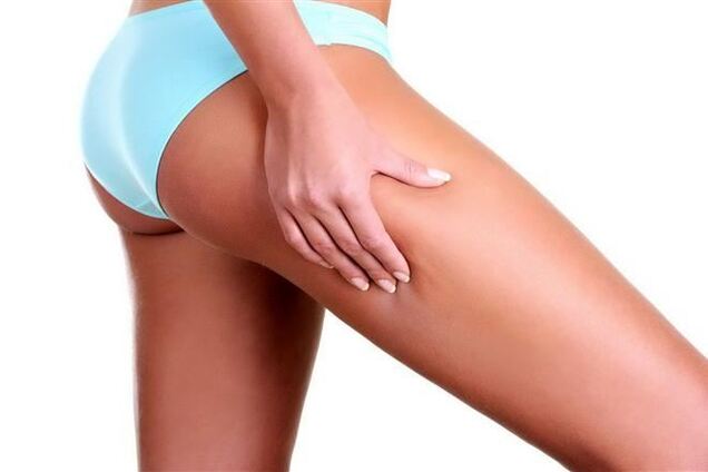 Камфарное масло спасет от целлюлита