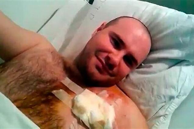 Активист 'Дорожного контроля': мне стреляли прямо в сердце