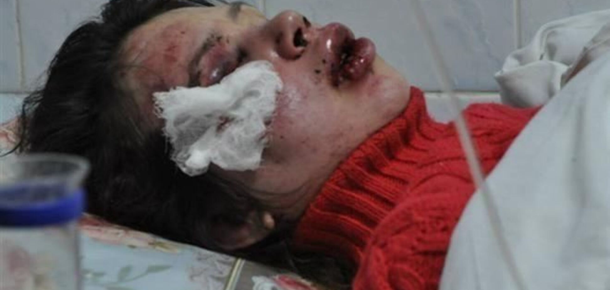 США вимагають покарати винних у побитті Чорновіл