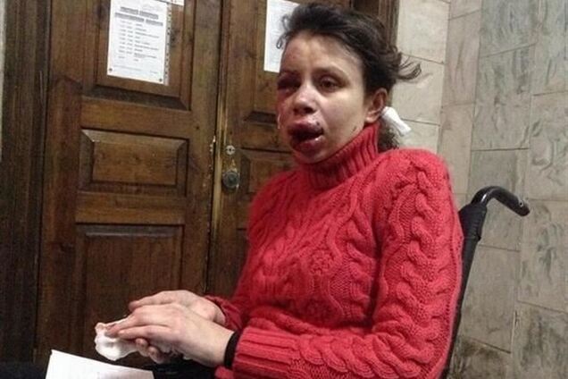 Рыбак об избиении Чорновил: это очень нехороший случай