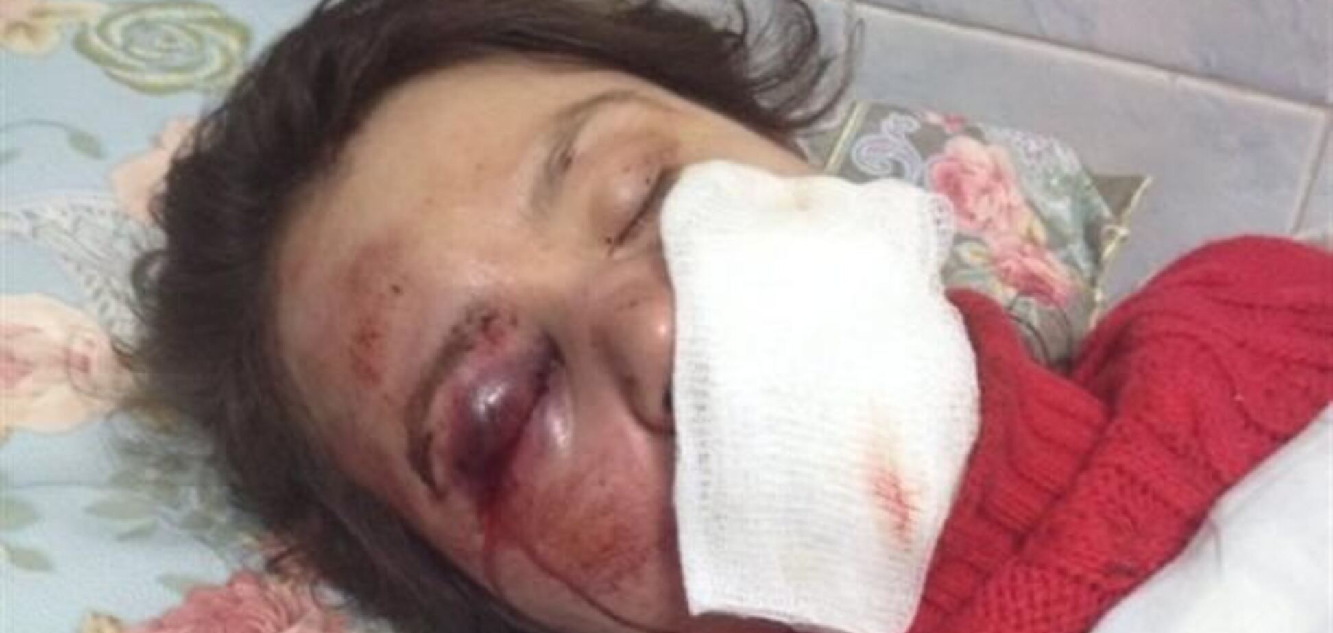 Видеорегистратор зафиксировал тех, кто избивал журналистку Чорновил