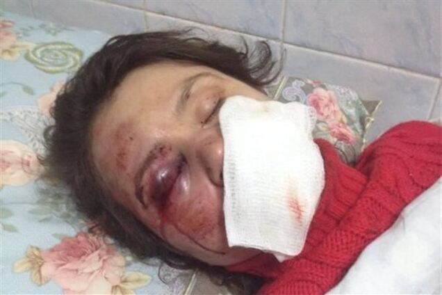 К Чорновил не пустили даже Яценюка - президент клиники 'Борис'