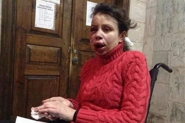 МИД: Президент осудил проявление насилия со стороны тех, кто избил Черновил