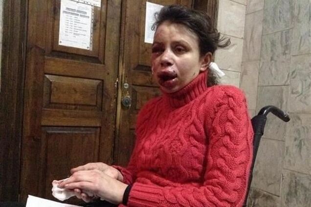 Подозреваемые в деле Чорновил тесно связаны с оппозиционерами - МВД