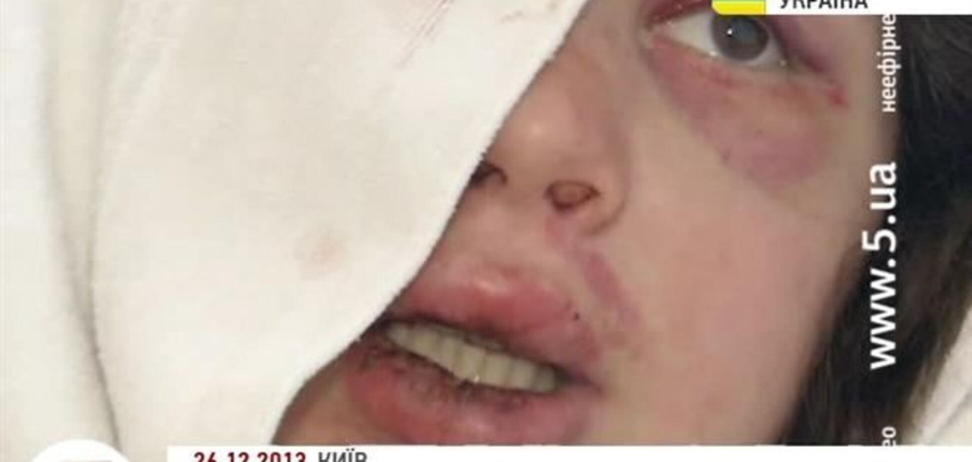 Медики могут отпустить Чорновил на Новый год домой