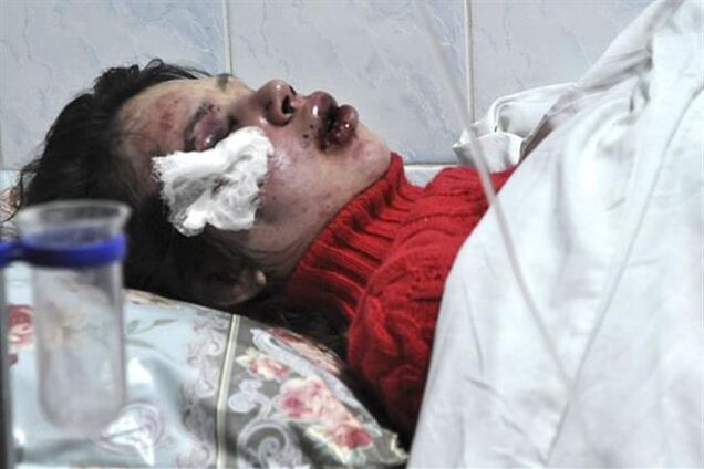 Избитую Татьяну Черновил сегодня прооперируют