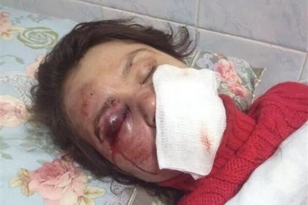 П'ятий фігурант у справі Чорновіл зізнався у побитті журналістки