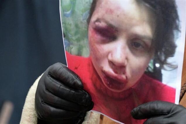 Чорновил не исключает, что ее избиение могло быть местью главы 'Беркута' Киева