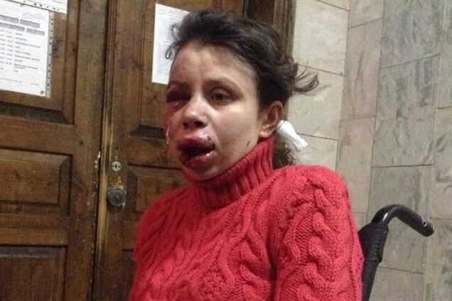 Милиция проанализировала записи видеонаблюдения по делу Чорновил