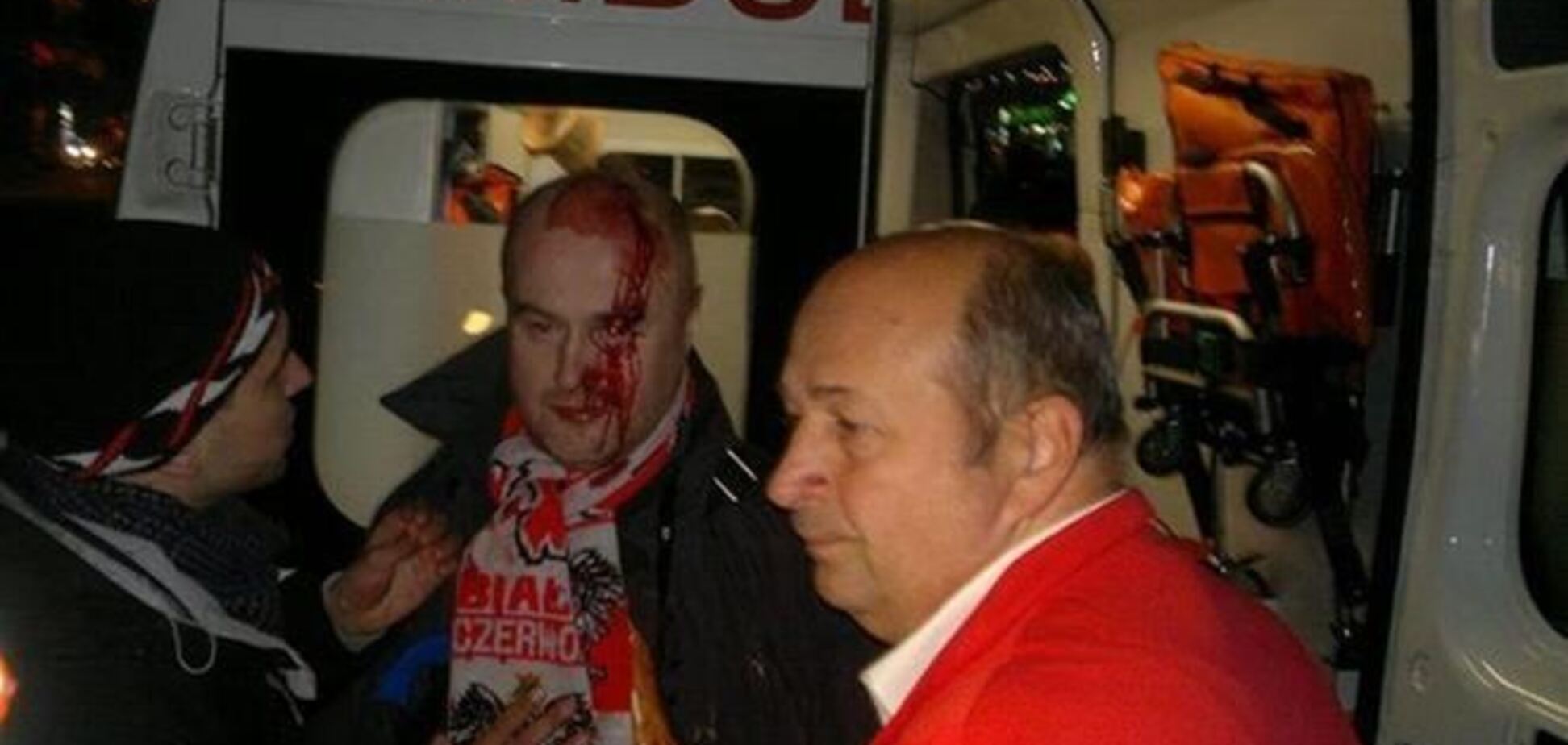 'Репортери без кордонів' стурбовані насильством проти журналістів на Евромайдане