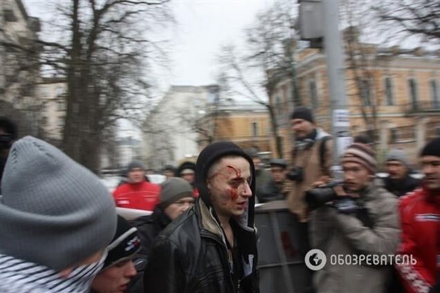 На Банковой появился человек в крови