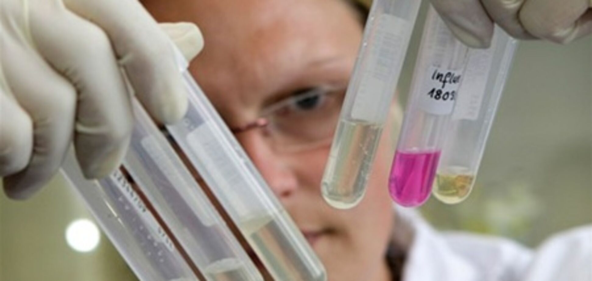 В России зафиксировали факт смерти от свиного гриппа