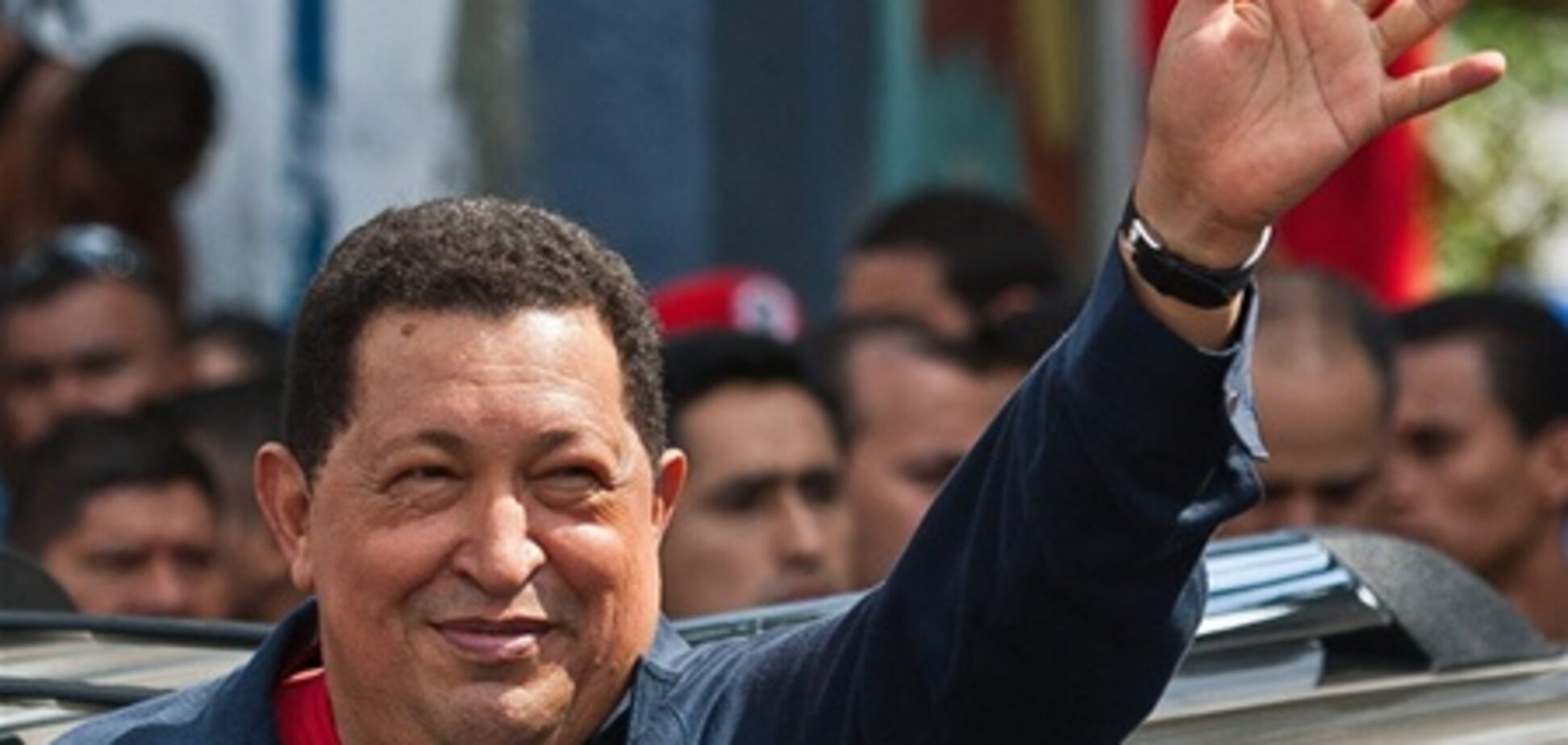 В состоянии Чавеса наметился 'стойкий прогресс'