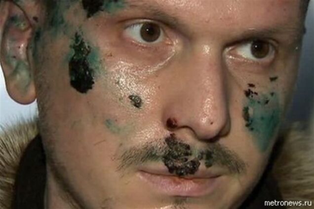 Обвиняемому в покушении на Путина грозит 15 лет тюрьмы