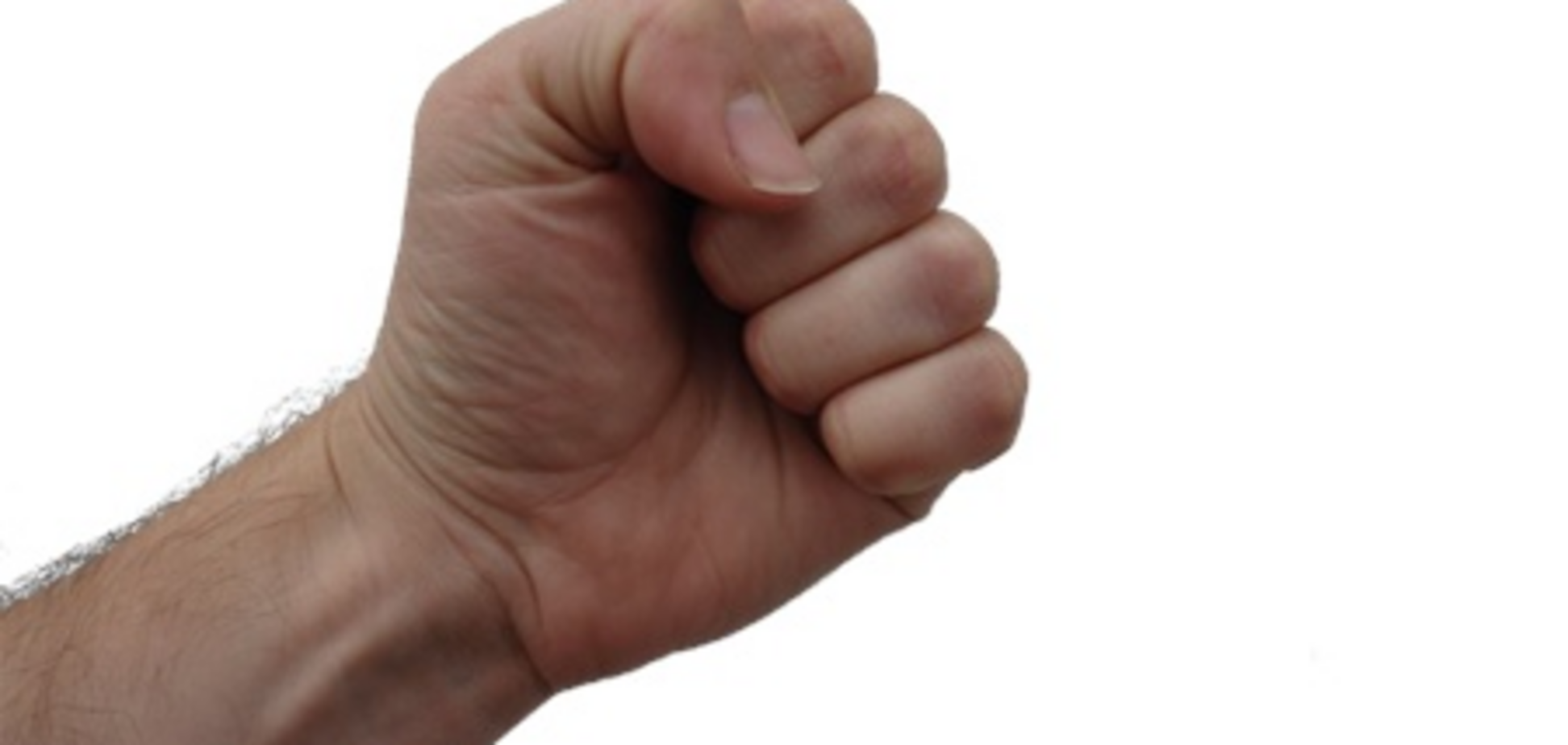 В Луцке посетители ночного клуба выбили зубы несговорчивой девушке