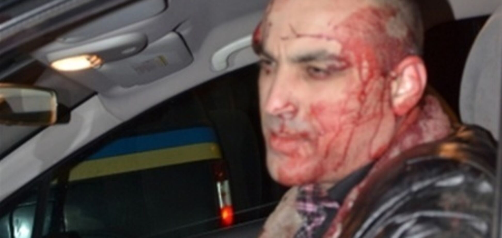 В Виннице избили главреда газеты