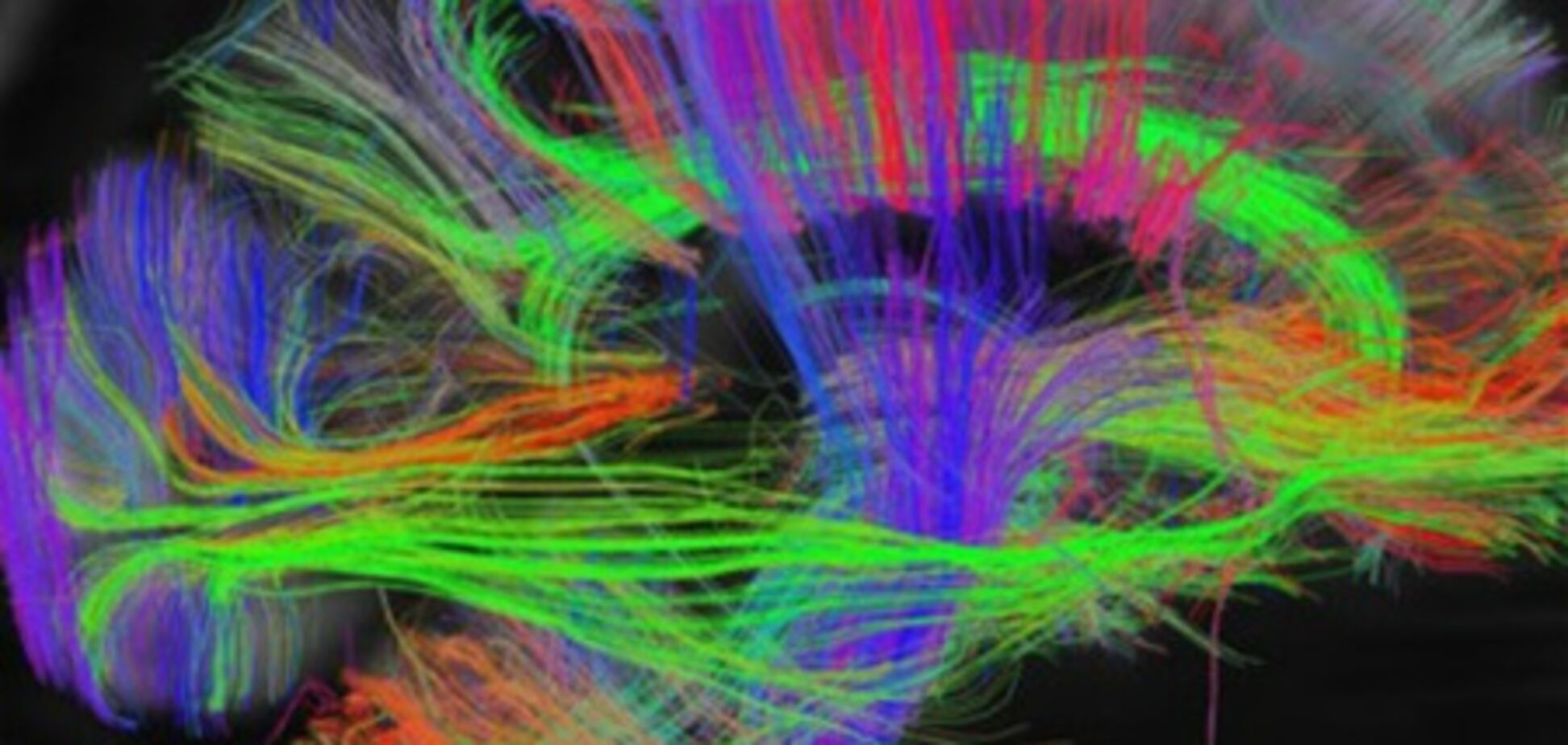 Ученые создали подробную карту мозга человека