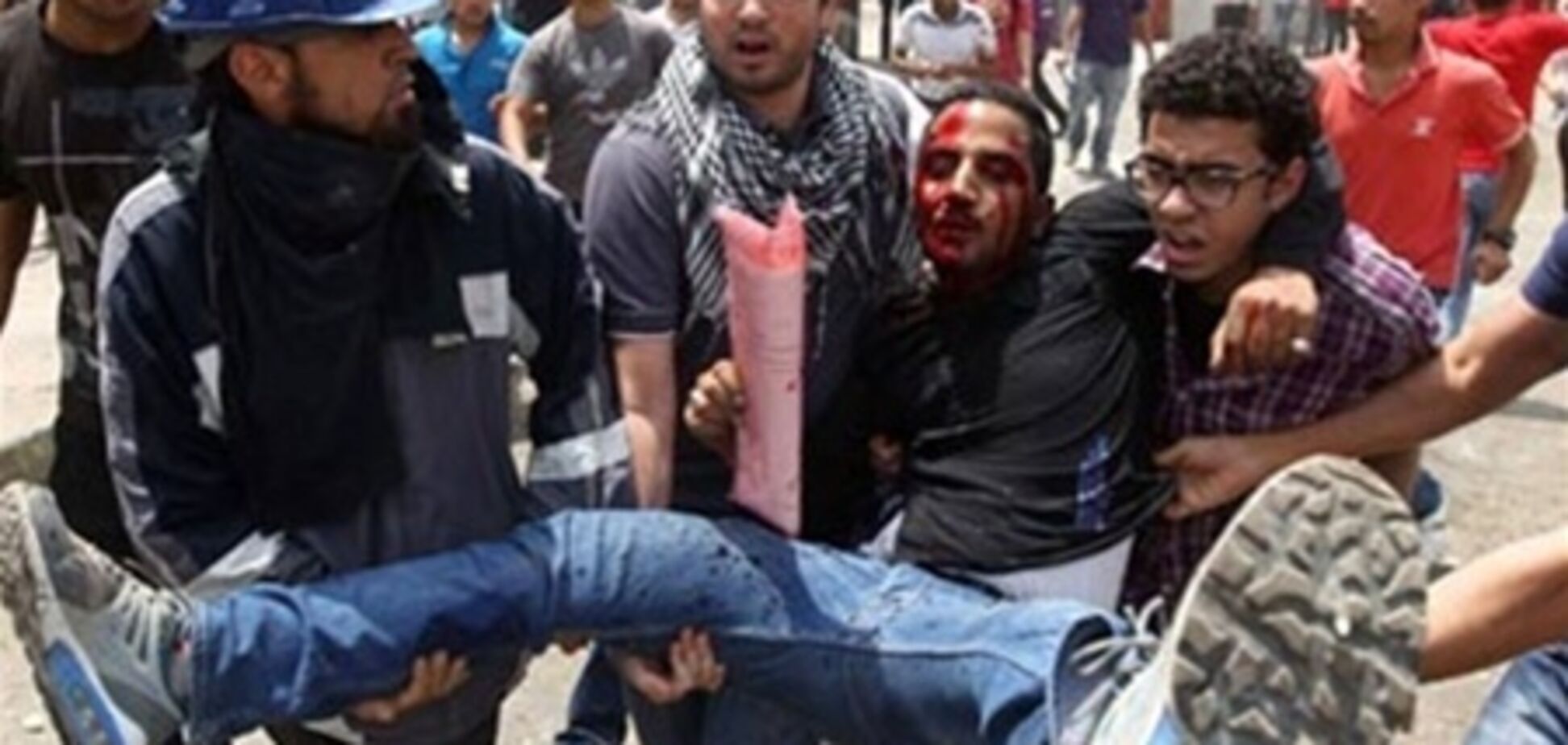ЗМІ: в Єгипті протестуючих оперували без анестезії