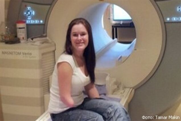 Ученые нашли источник фантомных болей после ампутации