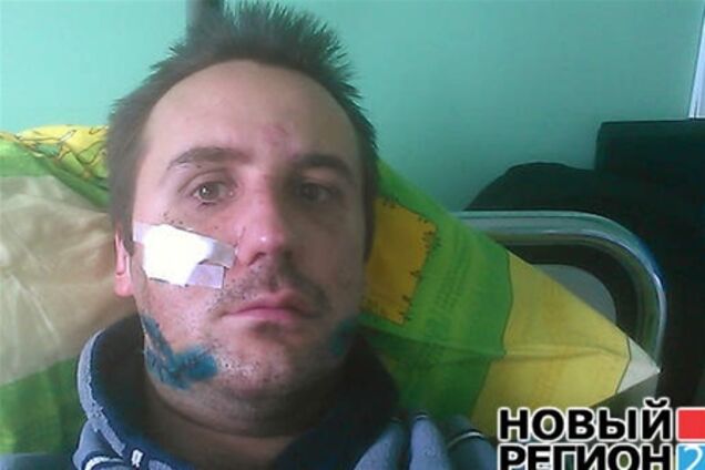 Побиття журналіста в Запоріжжі: постраждалий все ще в лікарні