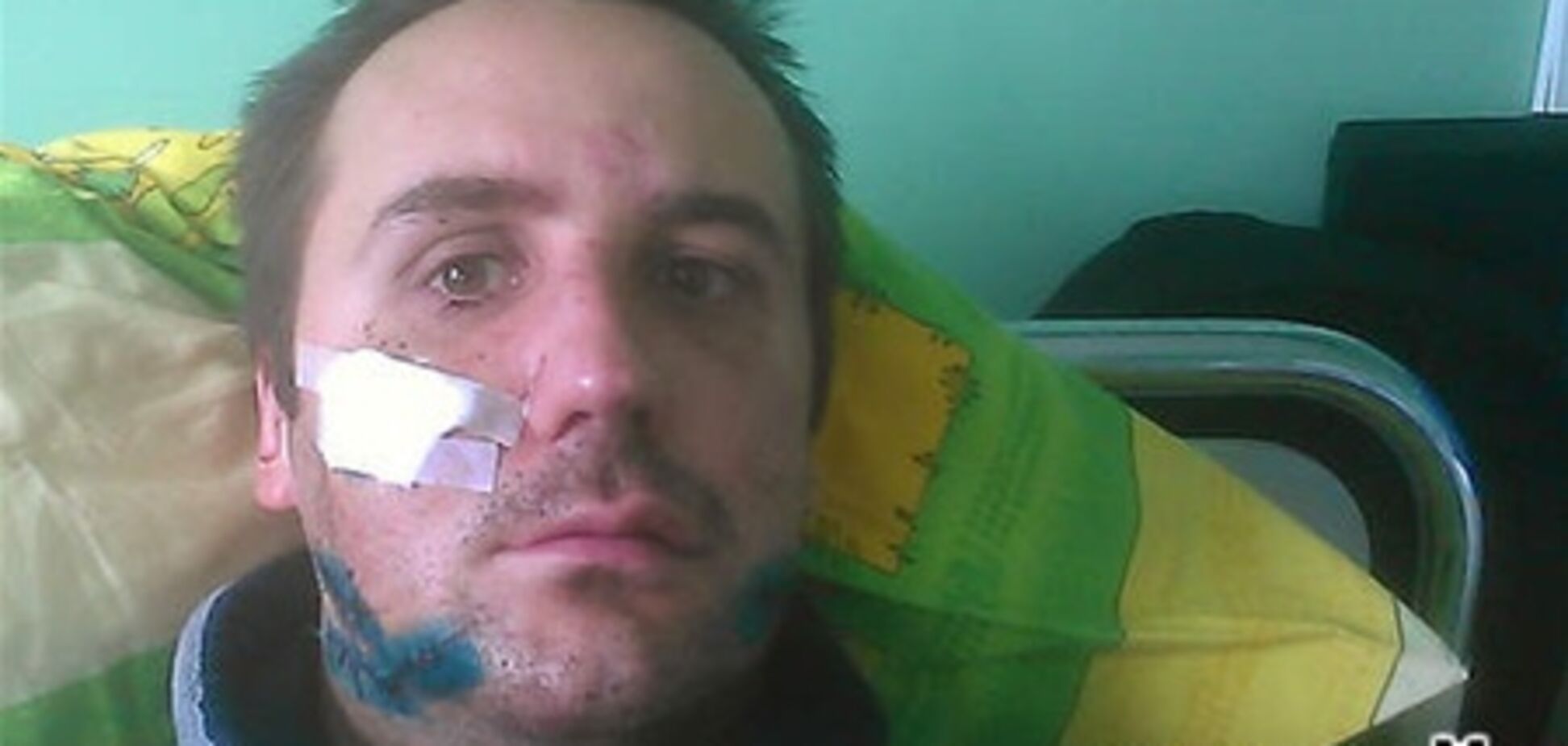 Избиение журналиста в Запорожье: пострадавший все еще в больнице