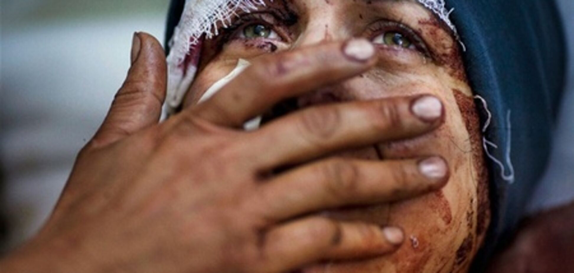 Березень став найкривавішим місяцем сирійського конфлікту - ЗМІ