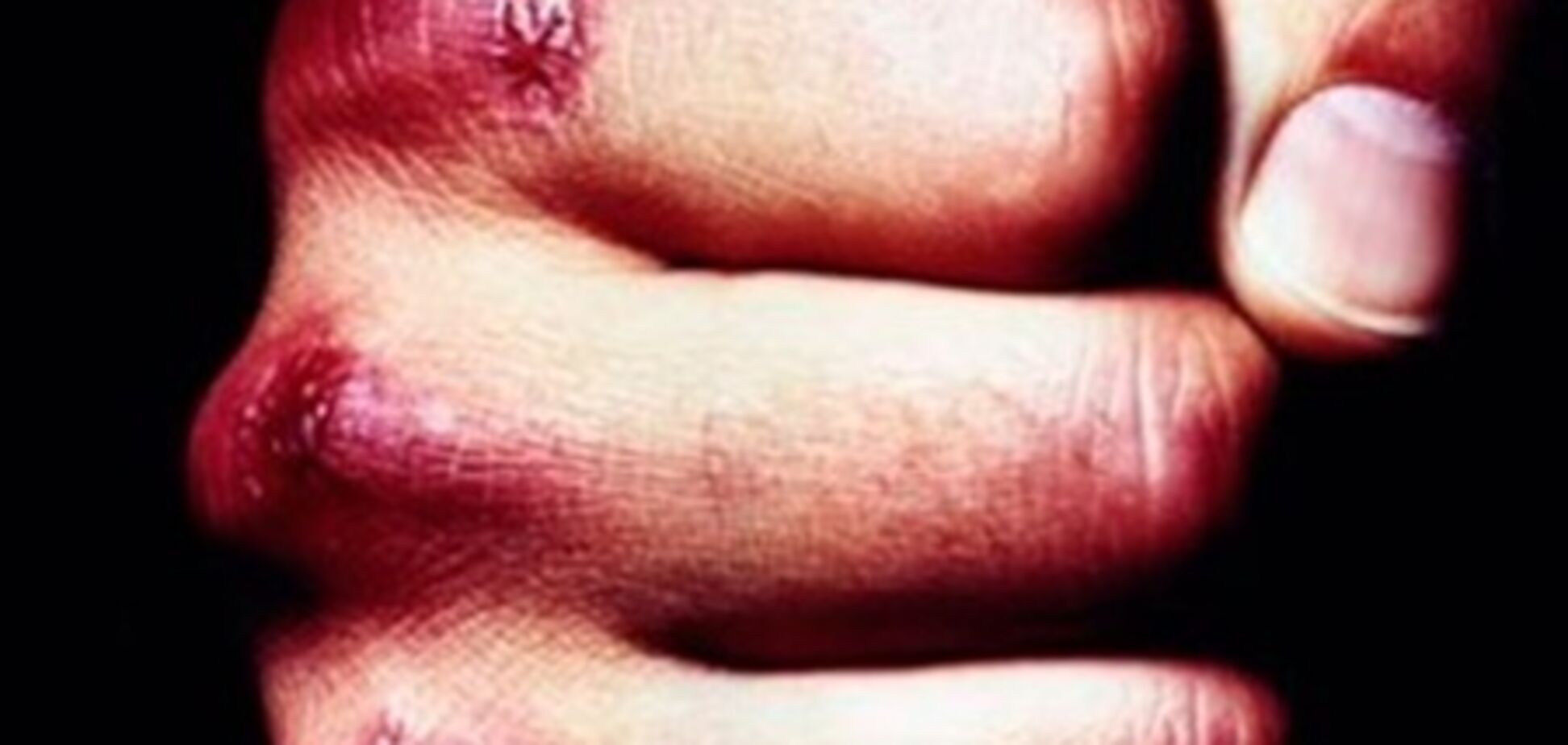 На Харьковщине люди устроили самосуд: убили воришку