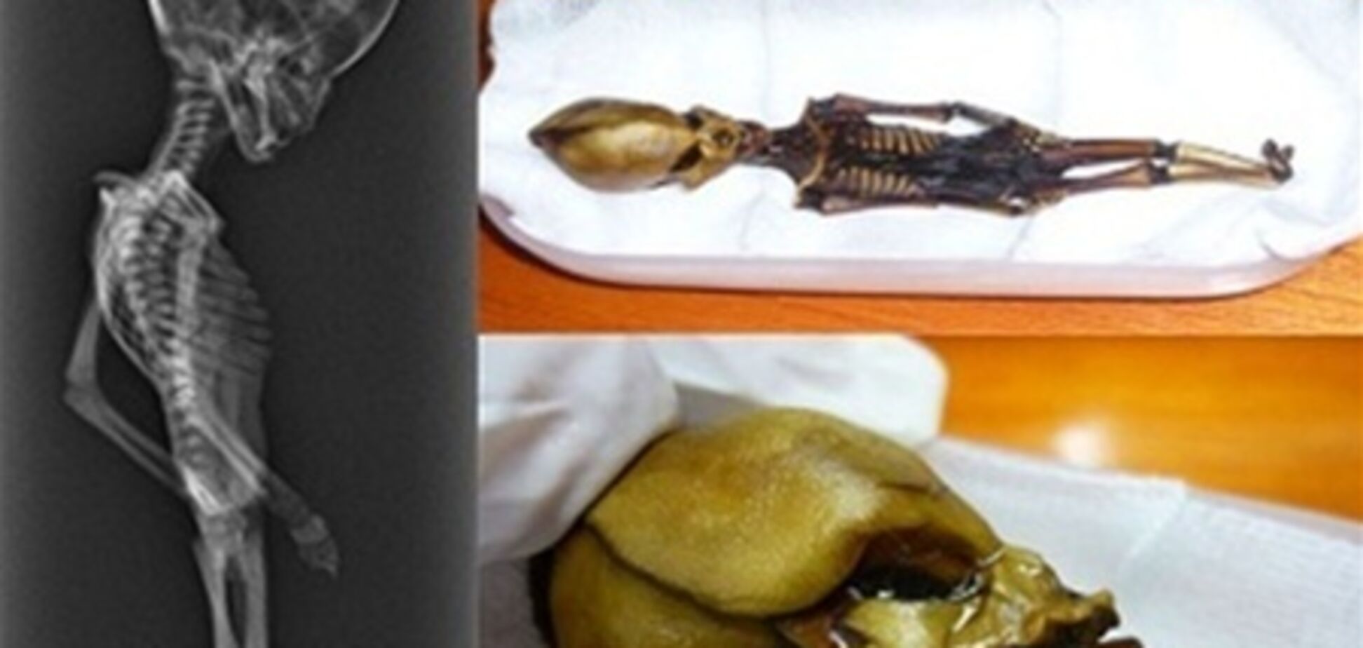 Атакамский 'пришелец' может быть нерожденным младенцем – ученый