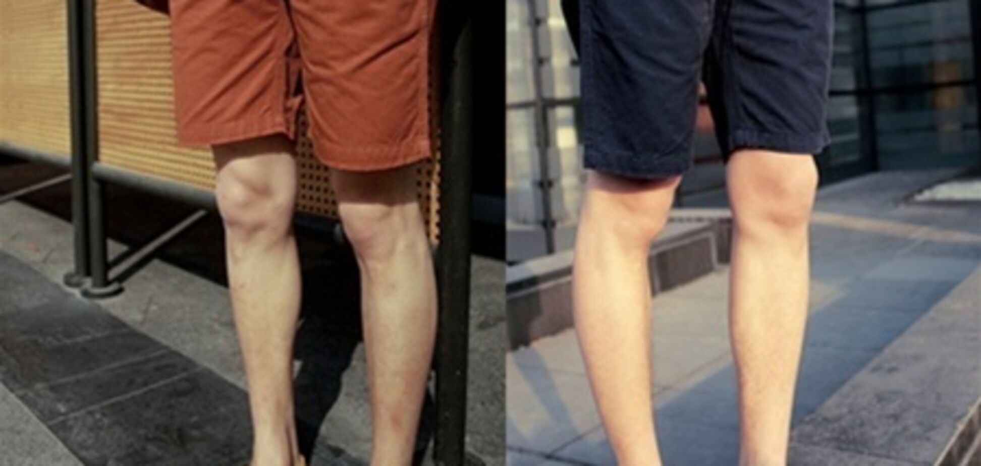 У мерію Миколаєва заборонили ходити в шортах і з господарськими сумками