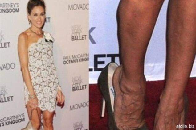 ТОП-10 самых некрасивых звездных ног. Фото