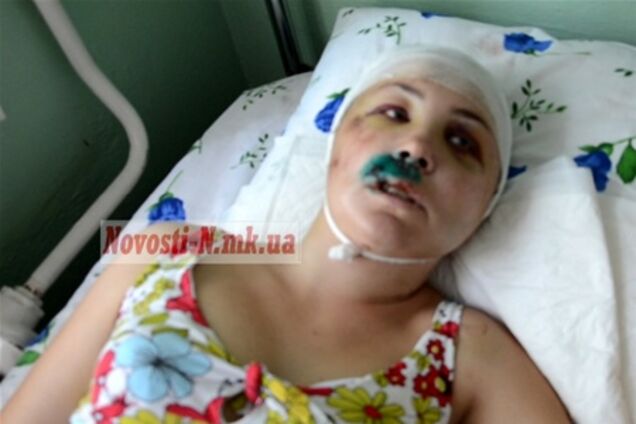 Жительница Николаевщины утверждает, что ее насиловали двое милиционеров