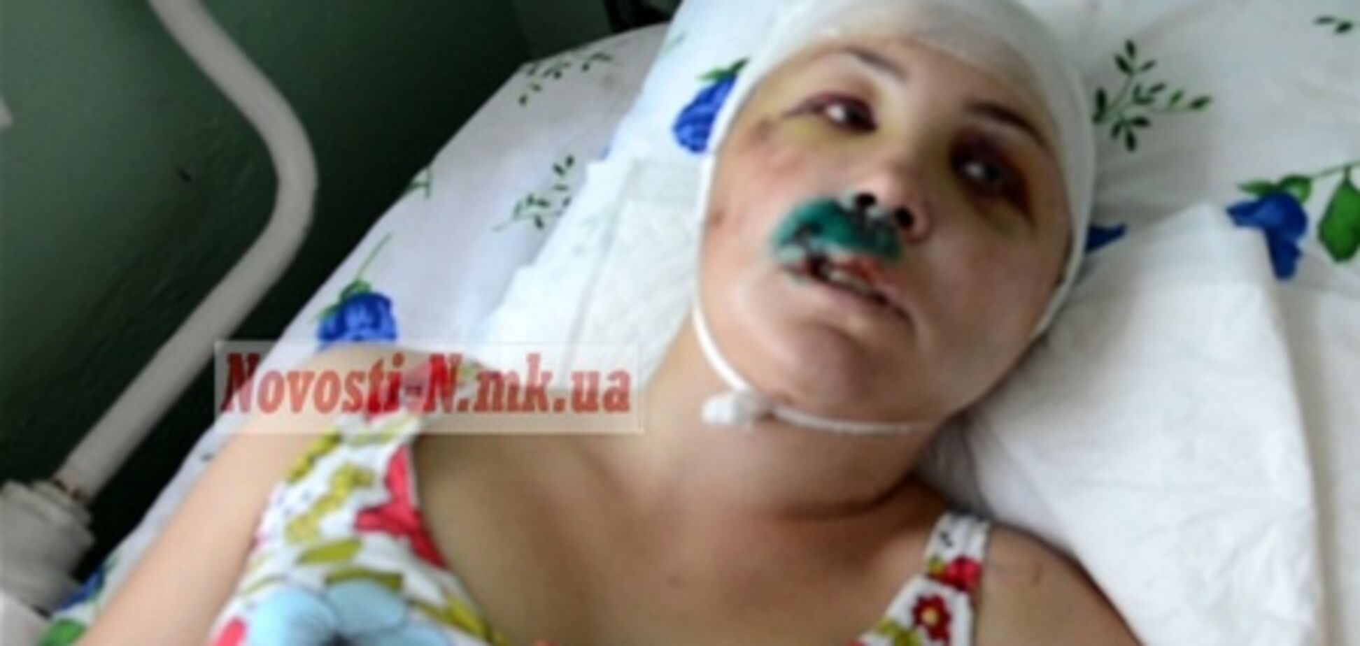 Жительница Николаевщины утверждает, что ее насиловали двое милиционеров