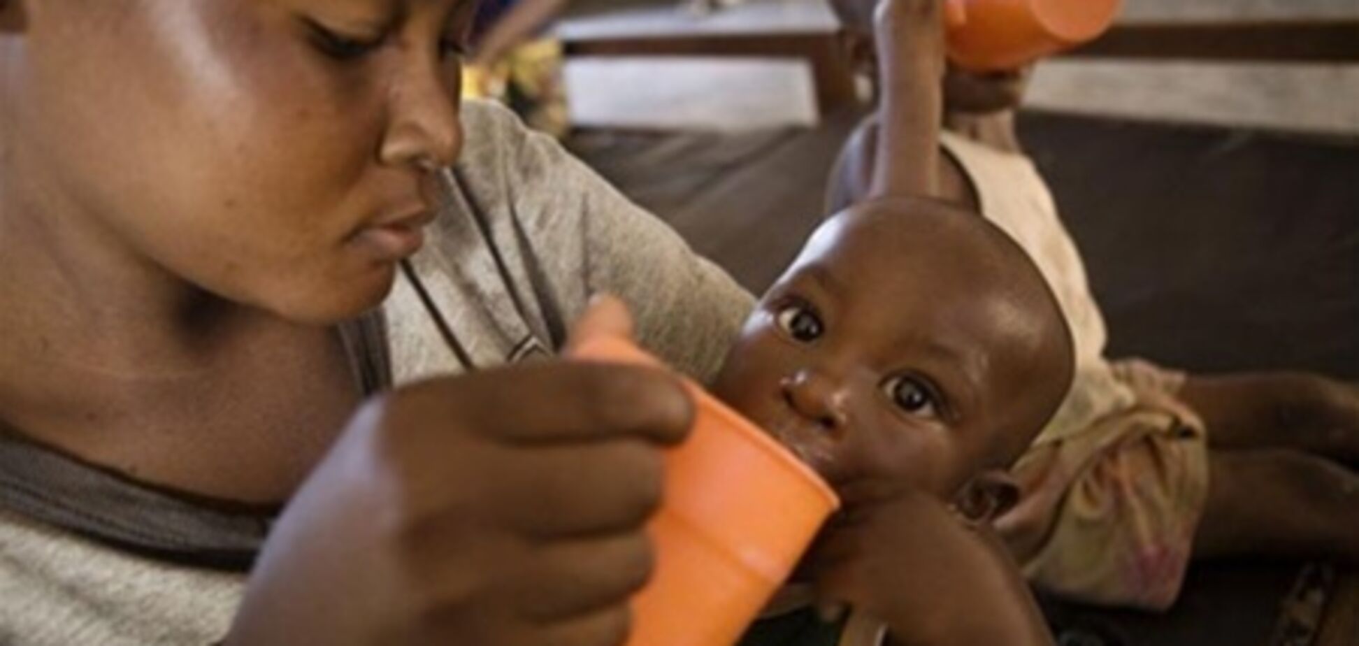 ООН: недоїдання дорого обходиться світовій економіці