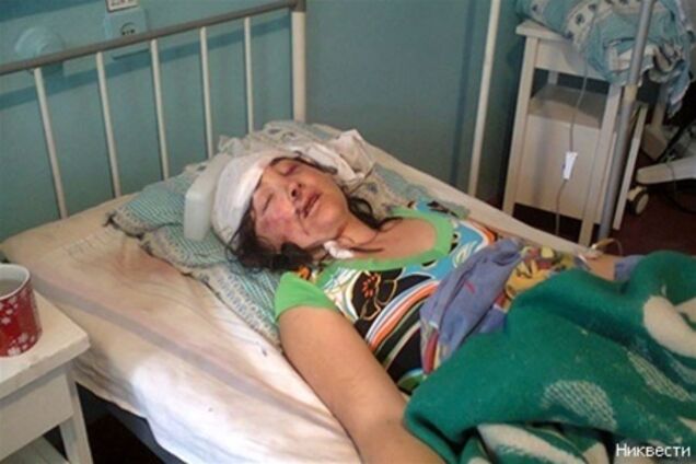 Згвалтування під Миколаєвом: впізнання проводили при світлі ліхтарика