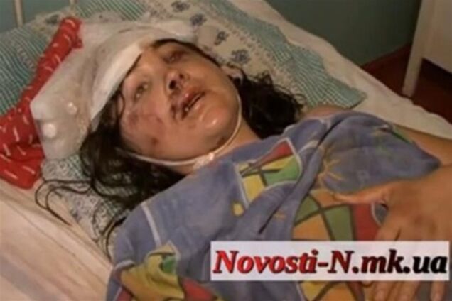 Прокуратура: подозреваемому в изнасиловании под Николаевом родственник не поможет