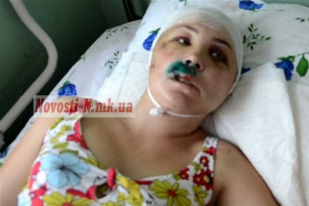 Изнасилование под Николаевом: один из подозреваемых - племянник прокурора