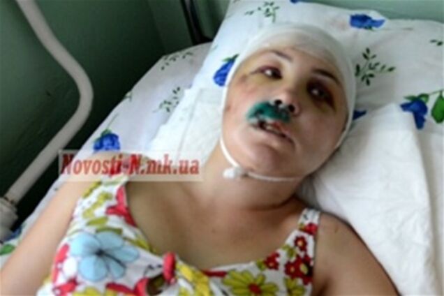 Изнасилование под Николаевом: прокуратура обещает честное расследование