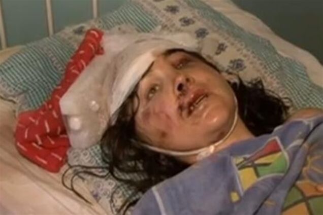 Насильников девушки под Николаевом зафиксировала камера