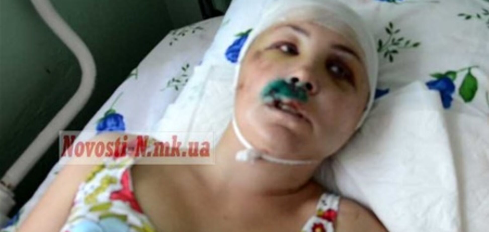 Милиция не предлагала оплатить лечение жертве изнасилования на Николаевщине