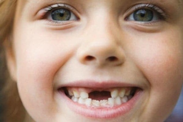  Ранняя потеря молочных зубов - стоит ли волноваться?