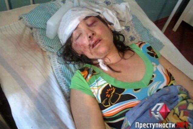 Жертву гвалтівників з Врадіївки можуть виписати наступного тижня