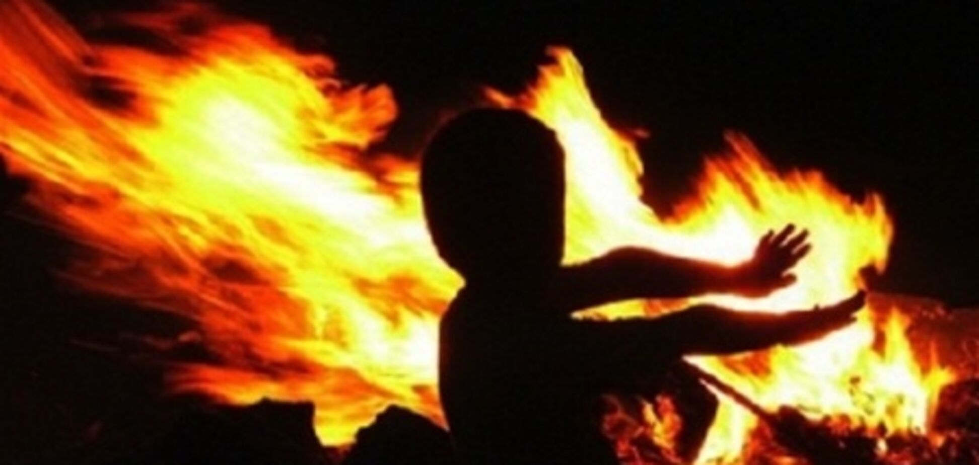 На Вінниччині дитина обпік обличчя, граючи з бензином