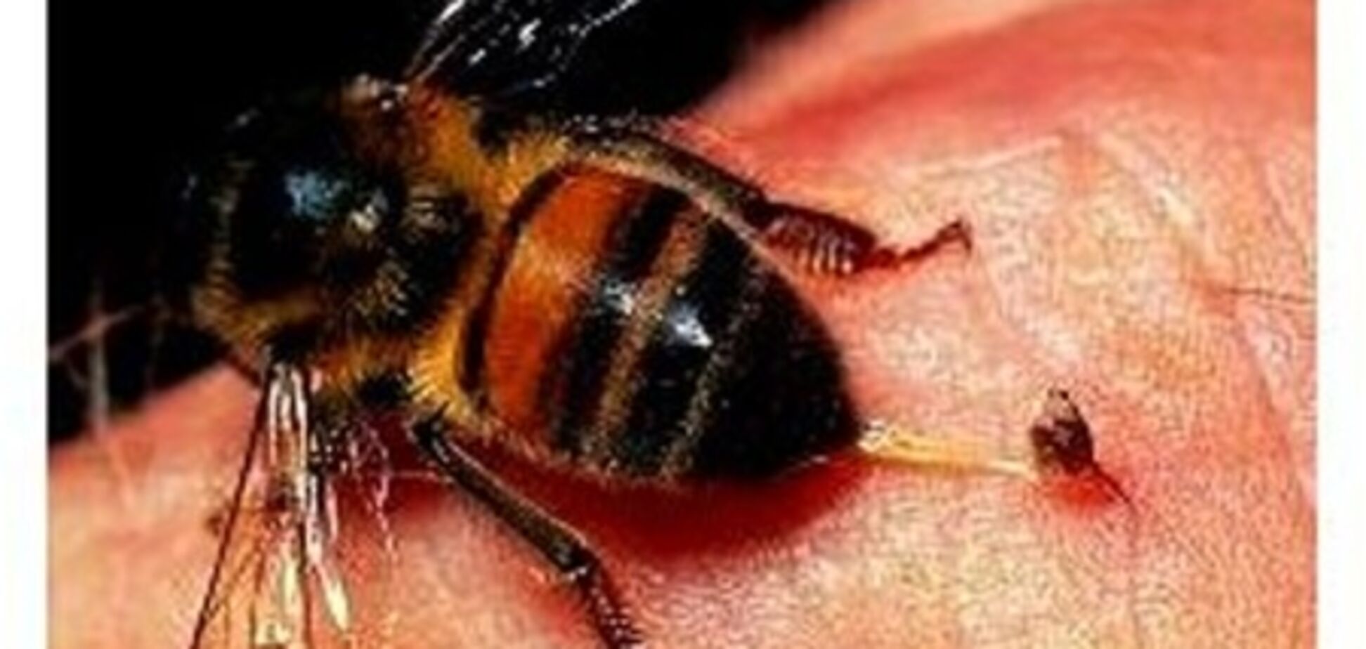 На Вінниччині бджоли відправили жінку до лікарні