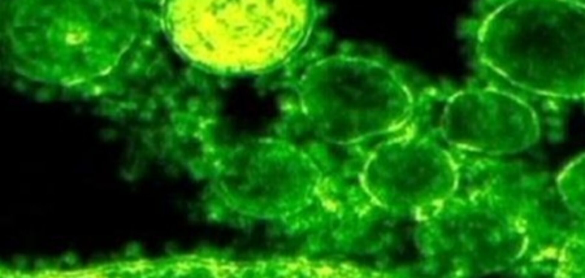 ВОЗ: новый коронавирус пока не опасен человечеству