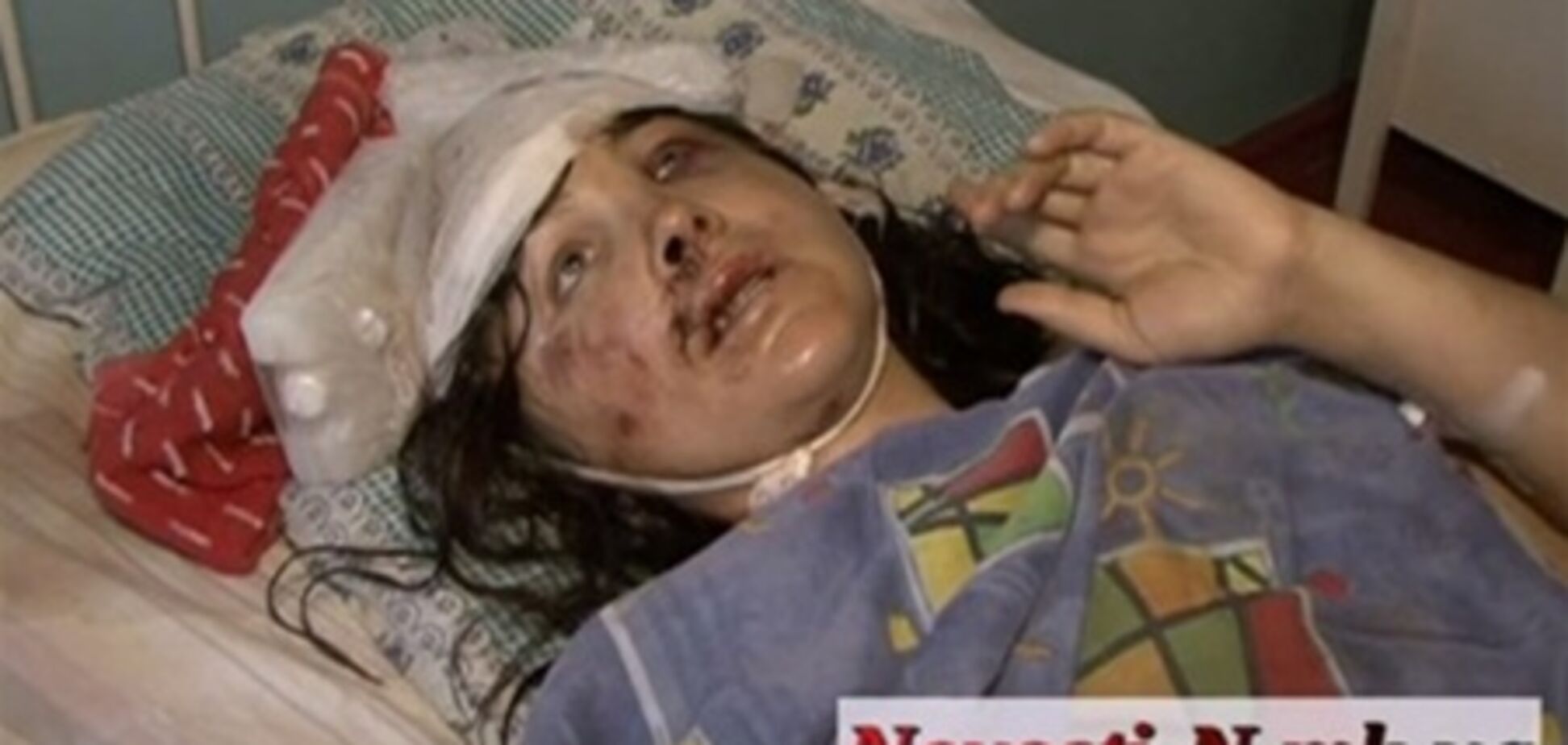 Пострадавшей во Врадиевке стало лучше